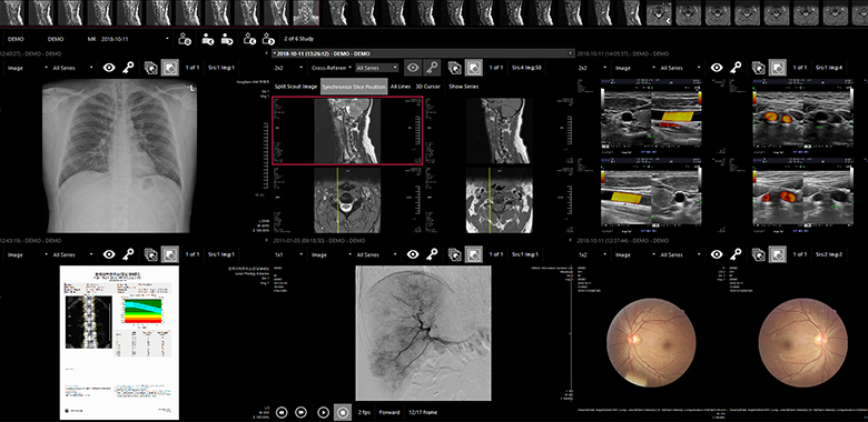 Software QXLink - Imagen 3
