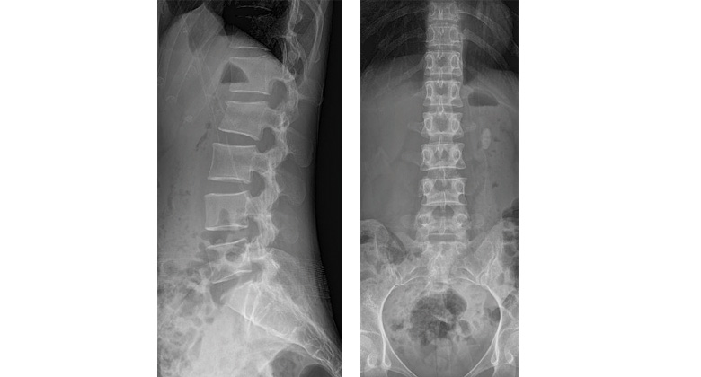 Detector VIVIX-S 4343VW - Imagen 2