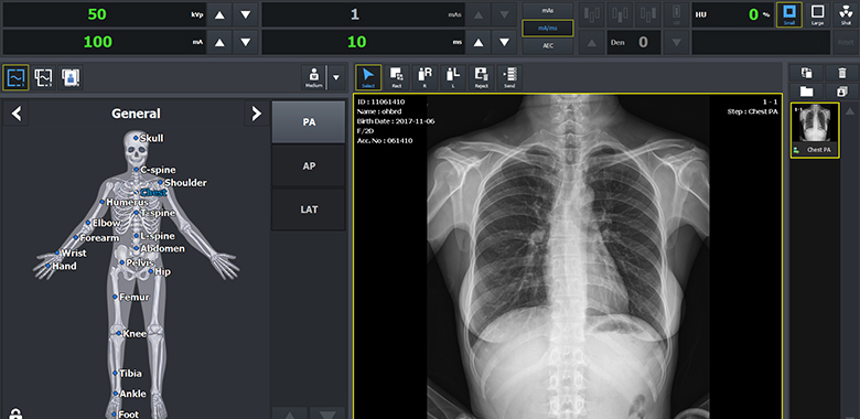 Software VXvue with PureImpact™ - Imagen 7