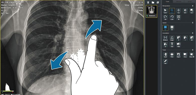 Software VXvue with PureImpact™ - Imagen 5