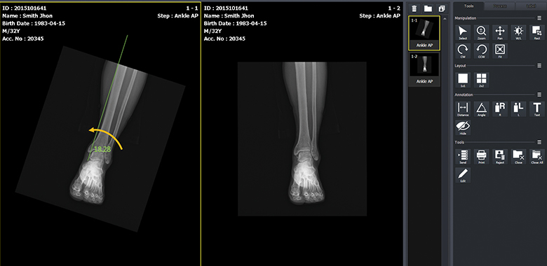 Software VXvue with PureImpact™ - Imagen 4