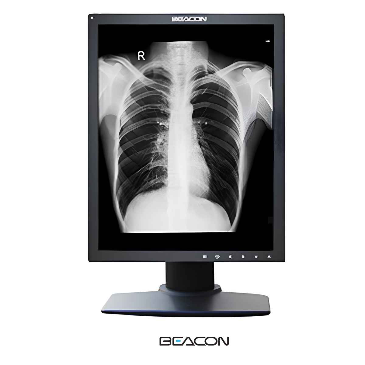 Beacon G22SP+ Monitor Grado Médico 2 Mp Monocromo / 21.3"