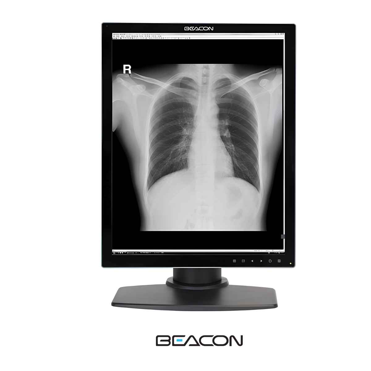 Beacon G32S+ Monitor Grado Médico 3 Mp Monocromo /21.3"
