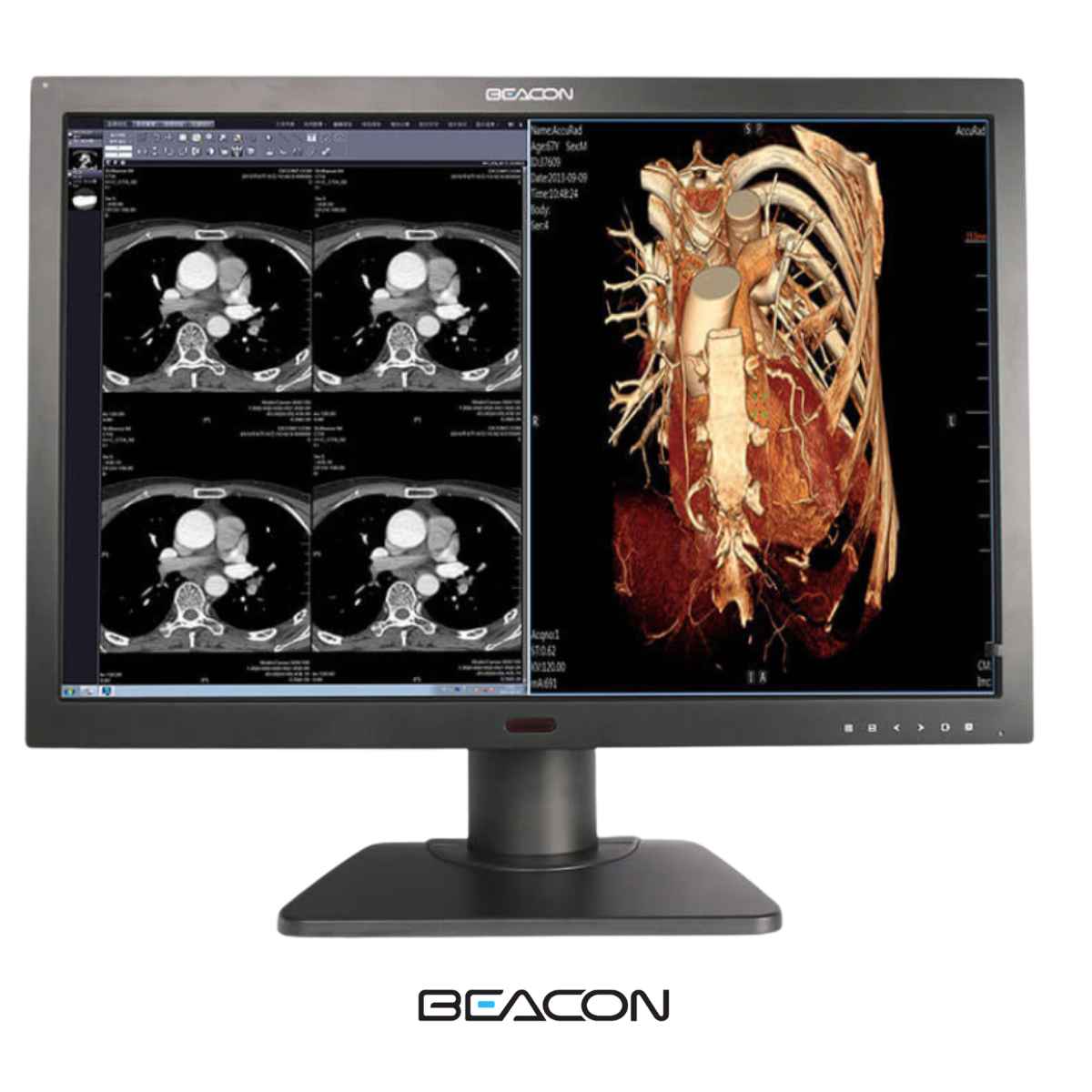 Beacon C61W+ Monitor Grado Médico 6 Mp Color / 30"