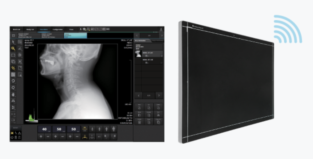 Sistema de DR Móvil TOPAZ - Imagen 4
