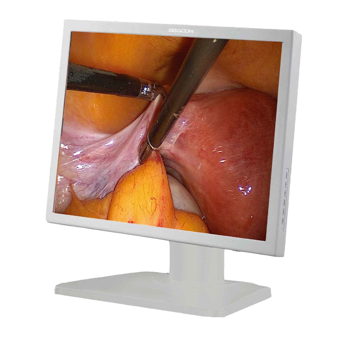 Beacon E190 - Monitor de Alta Definición de 19" para Cirugía Endoscópica