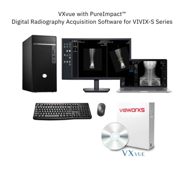 xvue