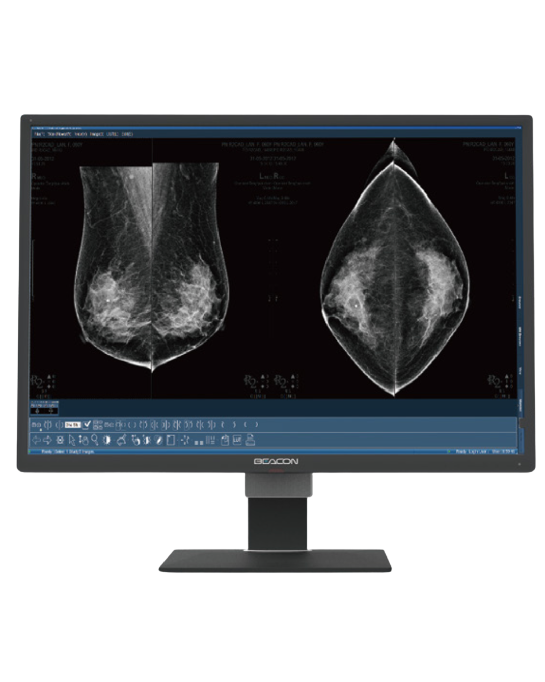 Beacon C1216W+ con Pantalla Doble Integrada de 12MP/ 31.5‘‘ Color