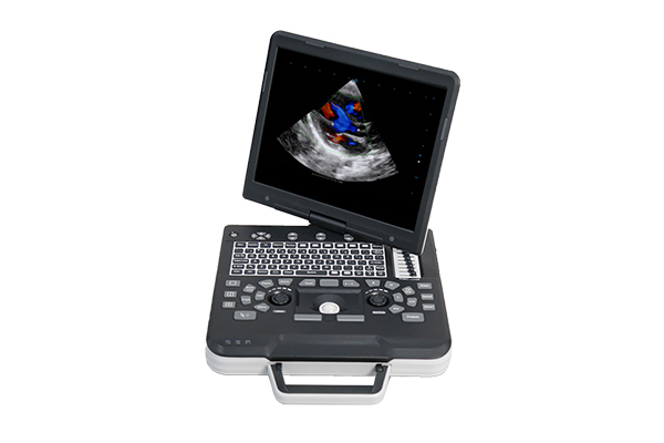 Ecógrafo Apogee 1000 Pro - Imagen 3