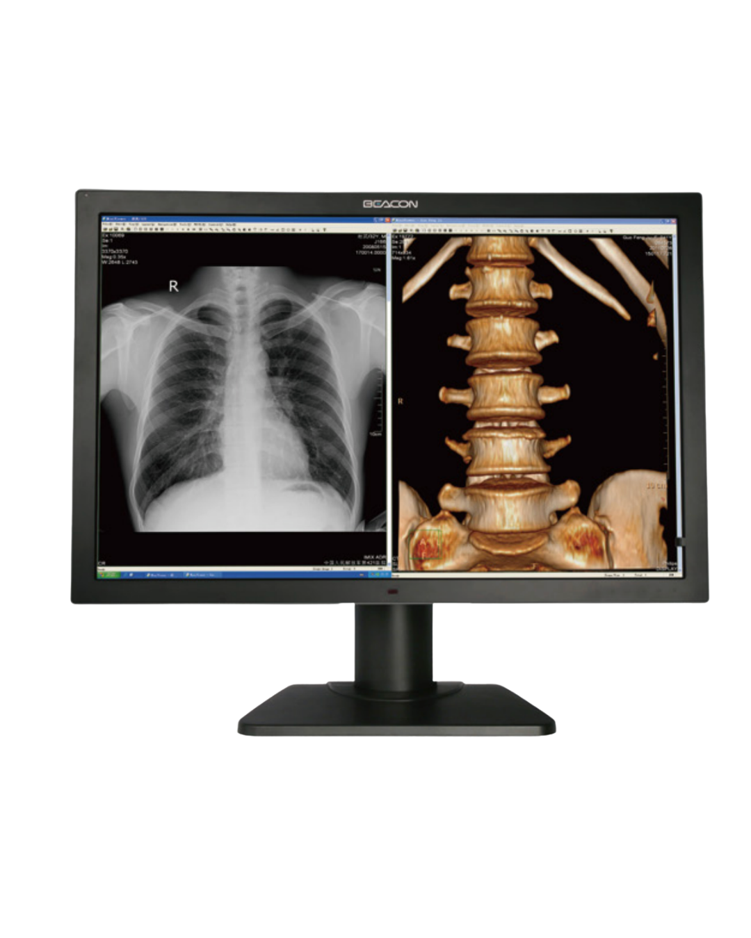 Beacon C82W+ con Pantalla Doble Integrada de 8MP/ 31.5‘‘ Color.