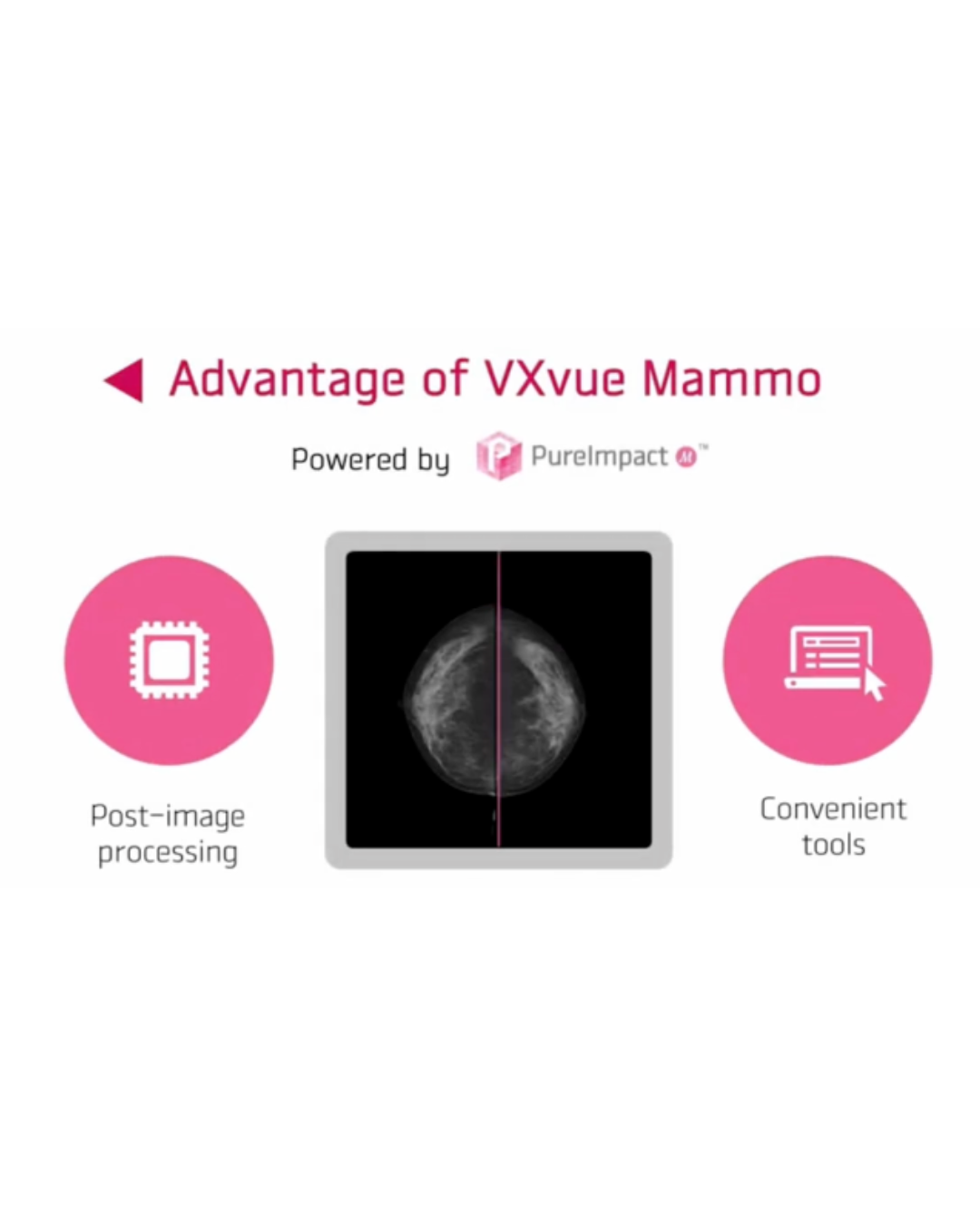 VXvue Mammo - Software de adquisición de mamografía digital - Imagen 4